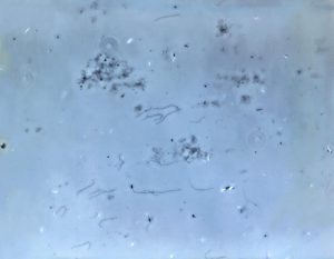 梅毒トレポネーマのスピロヘータの位相差顕微鏡画像