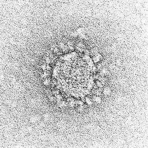 コロナウイルスの電子顕微鏡画像