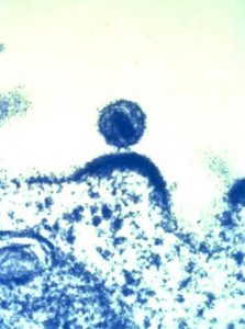 ヒト免疫不全ウイルス（HIV）の透過電子顕微鏡画像