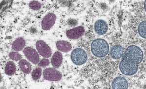 サル痘ウイルス粒子の電子顕微鏡の画像