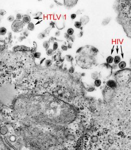 ヒト T 細胞白血病 1 型ウイルス (HTLV-1) の透過型電子顕微鏡画像